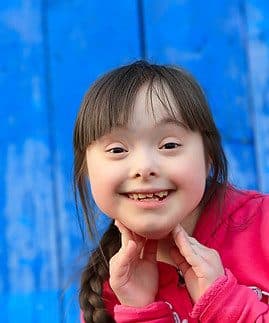 Child with Down syndrome receiving therapy